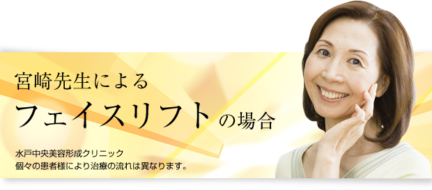 宮崎先生による顔のフェイスリフトの場合
