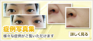 症例写真集