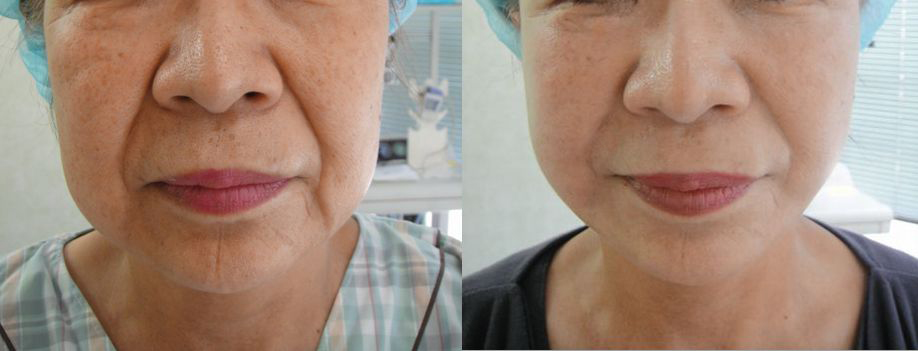 ファイル 23-1.jpg