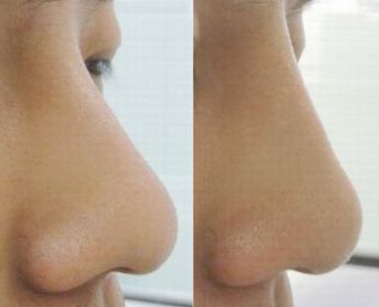 ファイル 24-2.jpg