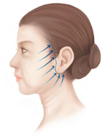 ファイル 75-2.png