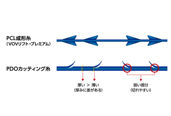 PCL成形糸(VOVリフト・プレミアム)PODカッティング糸