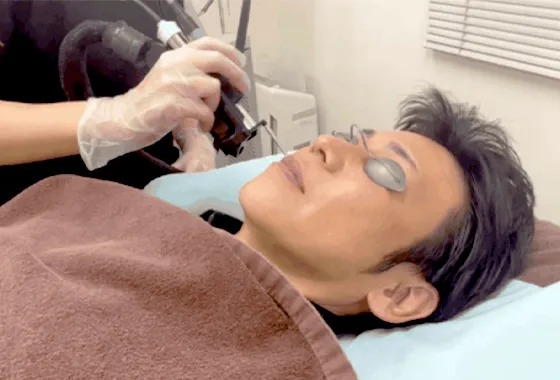 医療レーザー脱毛とは